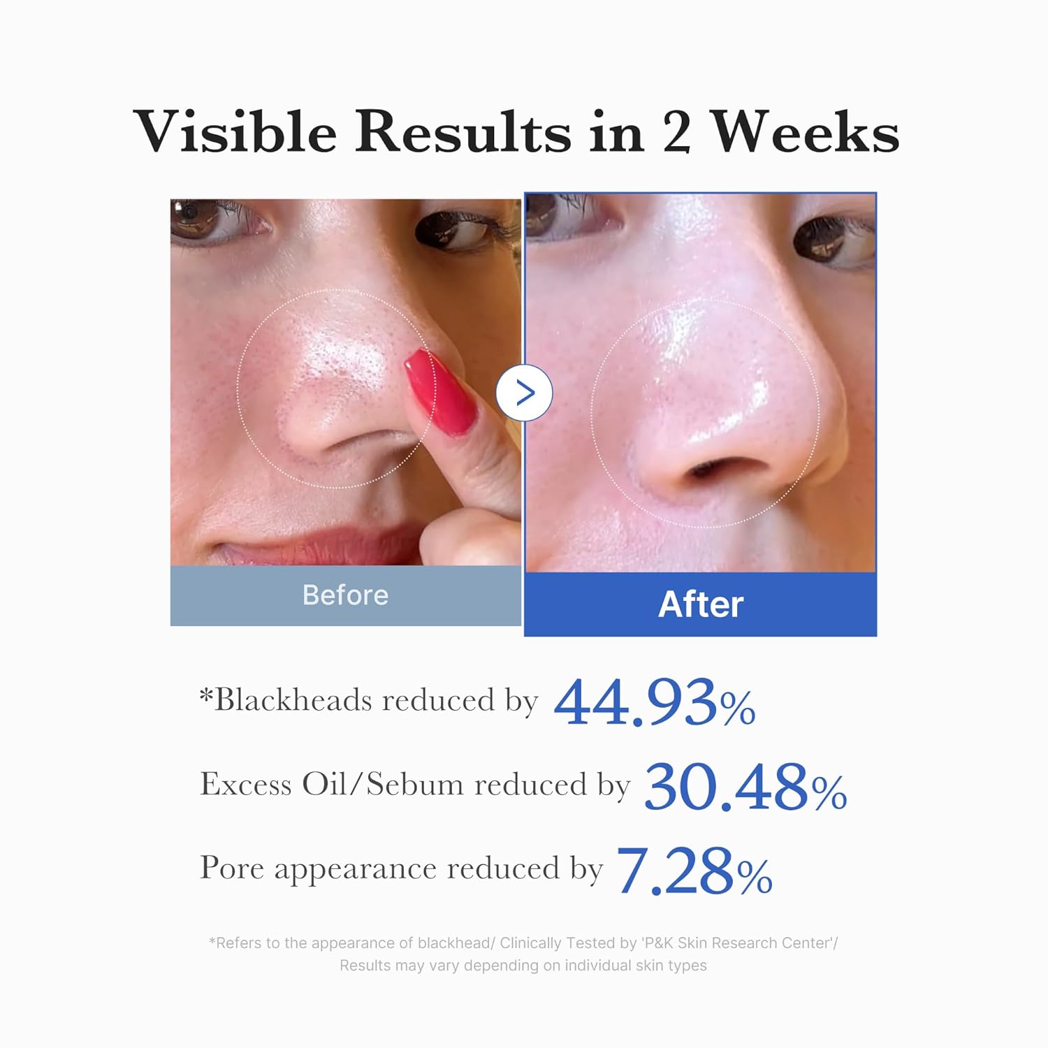 Zero Pore Dual Textured Pads
